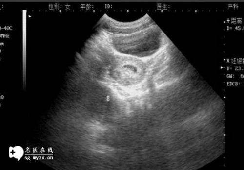 天津代怀服务：﻿新生儿凝血五项标准，揭秘宝宝的健康状况