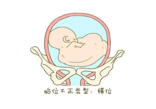 天津代生中心：﻿子宫出血多囊后是否影响怀孕？做这些能够有效阻止此病症的发生