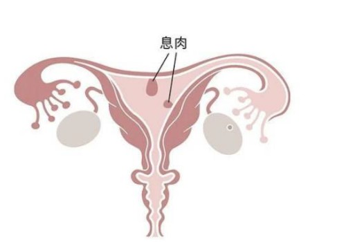 上海供卵试管：﻿内膜0.8cm持续无月经？了解着床怀孕几率的重要性