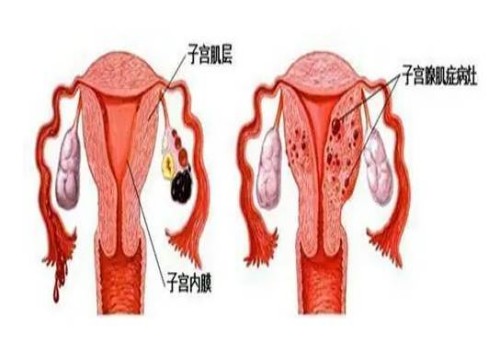天津代怀生子机构：﻿19至20周无预兆胎停？关于预防胎停育，这些事情你应该知道！